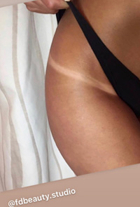 Résultats Spray Tanning